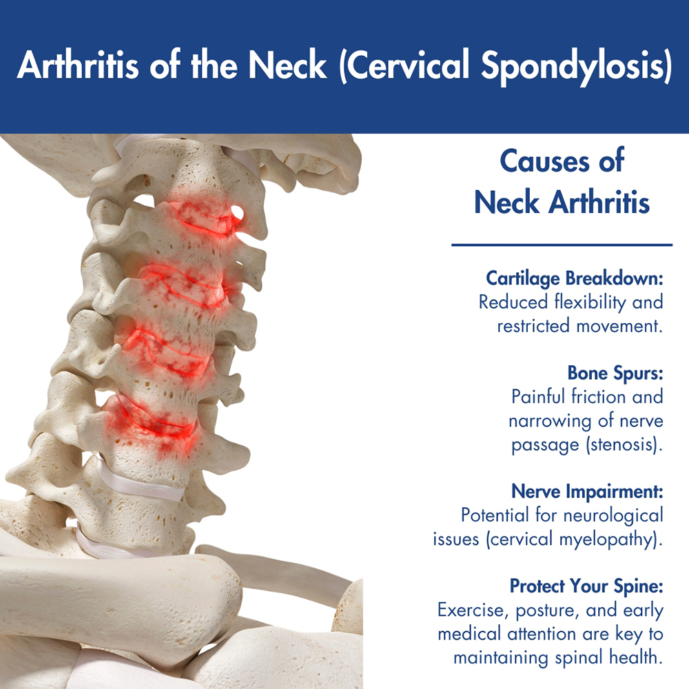 Arthritis of the Neck