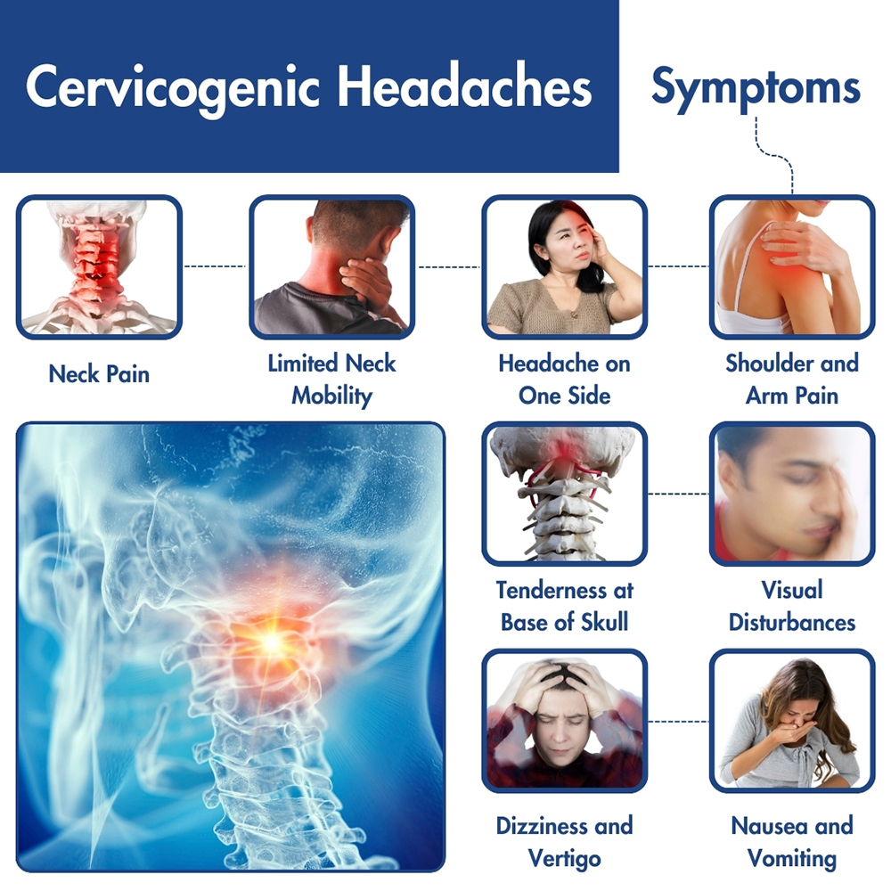 Cervicogenic Headaches