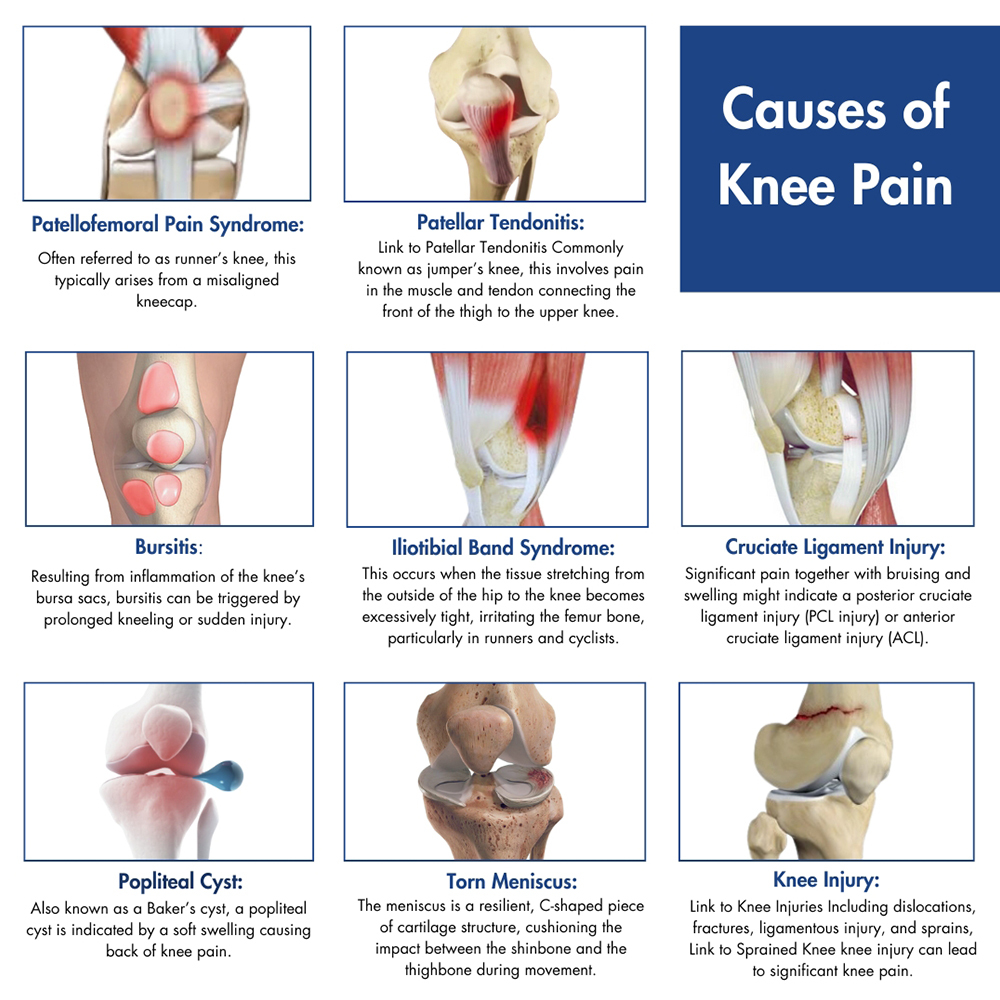 Causes of Knee Pain