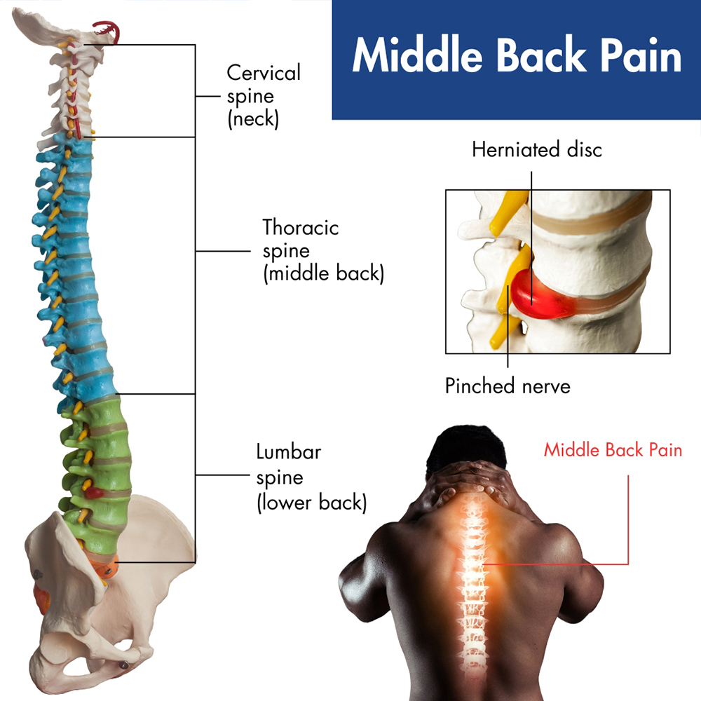 Middle Back Pain