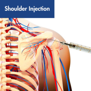 Shoulder Injection Note Shoulder Injections Madison, WI | Shoulder Pain Treatment Wisconsin