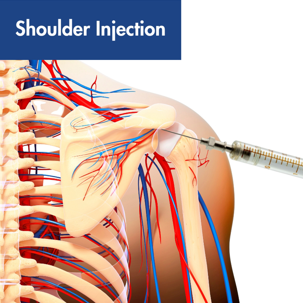 Shoulder Injection
